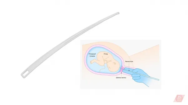 Amnioper (Amniohook) - disposable amniotomy hook